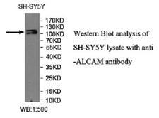 ALCAM / CD166 Antibody - Western blot of ALCAM / CD166 antibody