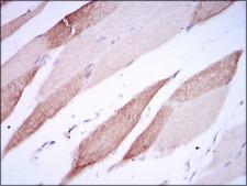 ALCAM / CD166 Antibody - IHC of paraffin-embedded striated muscle tissues using AlCAM mouse monoclonal antibody with DAB staining.
