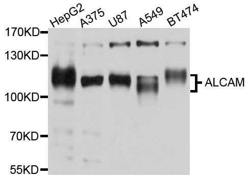 ALCAM / CD166 Antibody - Western blot analysis of extracts of SH-SY5Y cell and HT-1080 cells.
