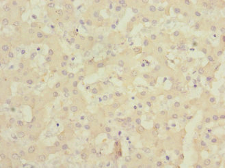 ALCAM / CD166 Antibody - Immunohistochemistry of paraffin-embedded human liver tissue at dilution 1:100