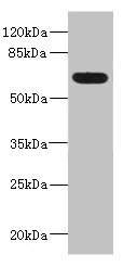 ALCAM / CD166 Antibody - Western blot All Lanes: ALCAMantibody IgG at 5.36ug/ml+ Mouse kidney tissue Secondary Goat polyclonal to rabbit IgG at 1/10000 dilution Predicted band size: 66,64,16,34 kDa Observed band size: 65 kDa