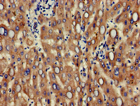ALCAM / CD166 Antibody - Immunohistochemistry of paraffin-embedded human liver tissue at dilution of 1:100