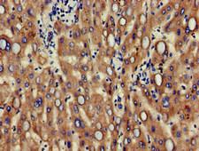 ALCAM / CD166 Antibody - Immunohistochemistry of paraffin-embedded human liver tissue at dilution of 1:100