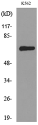 ALCAM / CD166 Antibody - Western blot analysis of lysate from K562 cells, using ALCAM Antibody.