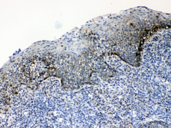ALCAM / CD166 Antibody - IHC testing of FFPE human tonsil tissue with CD166 antibody at 1ug/ml. Required HIER: steam section in pH6 citrate buffer for 20 min and allow to cool prior to testing.