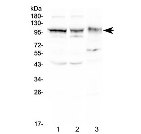 ALCAM / CD166 Antibody - Western blot testing of 1) rat brain, 2) mouse brain and 3) human A549 lysate with CD166 antibody at 0.5ug/ml. Predicted molecular weight ~65 kDa (unmodified), 100-105 kDa (glycosylated).