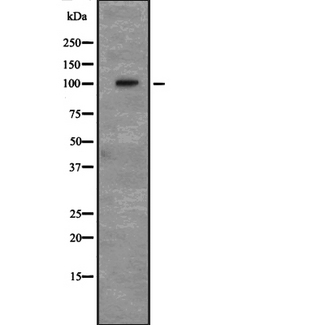 ALCAM / CD166 Antibody - Western blot analysis of CD166 expression in HEK293 cells. The lane on the left is treated with the antigen-specific peptide.