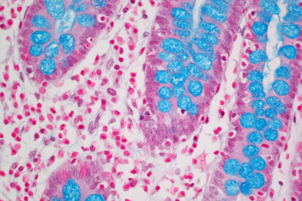 Product - Colon Tissue stained with Alcian Blue (ph 2.5).