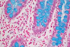 Colon Tissue stained with Alcian Blue (ph 2.5).