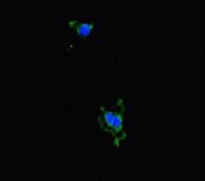 ALDH16A1 Antibody - Immunofluorescent analysis of HeLa cells diluted at 1:100 and Alexa Fluor 488-congugated AffiniPure Goat Anti-Rabbit IgG(H+L)