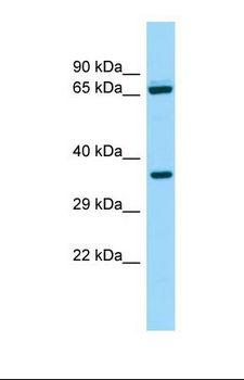 ALDH16A1 Antibody - Western blot of Human ACHN. ALDH16A1 antibody dilution 1.0 ug/ml.  This image was taken for the unconjugated form of this product. Other forms have not been tested.