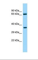 ALDH16A1 Antibody - Western blot of Human ACHN. ALDH16A1 antibody dilution 1.0 ug/ml.  This image was taken for the unconjugated form of this product. Other forms have not been tested.