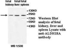 ALDH18A1 Antibody
