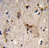 ALDH18A1 Antibody - Formalin-fixed and paraffin-embedded human brain tissue reacted with ALDH18A1 Antibody , which was peroxidase-conjugated to the secondary antibody, followed by DAB staining. This data demonstrates the use of this antibody for immunohistochemistry; clinical relevance has not been evaluated.