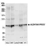 ALDH18A1 Antibody - Detection of human and mouse ALDH18A1/P5CS by western blot. Samples: Whole cell lysate (50 µg) from HeLa, HEK293T, Jurkat, mouse TCMK-1, and mouse NIH 3T3 cells prepared using NETN lysis buffer. Antibody: Affinity purified rabbit anti-ALDH18A1/P5CS antibody used for WB at 0.04 µg/ml. Detection: Chemiluminescence with an exposure time of 10 seconds.
