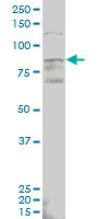 ALDH18A1 Antibody - ALDH18A1 monoclonal antibody (M01), clone 2B5 Western Blot analysis of ALDH18A1 expression in MCF-7.
