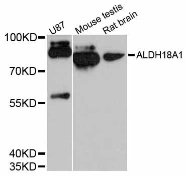 ALDH18A1 Antibody - Western blot analysis of extracts of various cell lines, using ALDH18A1 antibody at 1:3000 dilution. The secondary antibody used was an HRP Goat Anti-Rabbit IgG (H+L) at 1:10000 dilution. Lysates were loaded 25ug per lane and 3% nonfat dry milk in TBST was used for blocking. An ECL Kit was used for detection and the exposure time was 90s.