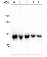 ALDH18A1 Antibody - Western blot analysis of P5CS expression in HCT116 (A), Panc1 (B), SGC7901 (C), A375 (D), mouse embryo (E) whole cell lysates.