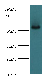 ALDH1A1 / ALDH1 Antibody - Western blot. All lanes: Retinal dehydrogenase 1 antibody at 4 ug/ml+mouse liver tissue. Secondary antibody: Goat polyclonal to rabbit at 1:10000 dilution. Predicted band size: 55 kDa. Observed band size: 55 kDa Immunohistochemistry.