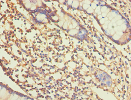 ALDH1A1 / ALDH1 Antibody - Immunohistochemistry of paraffin-embedded human small intestine using antibody at 1:100 dilution.
