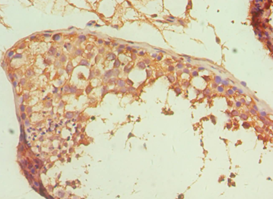 ALDH1A1 / ALDH1 Antibody - Immunohistochemistry of paraffin-embedded human testicle using antibody at 1:100 dilution.