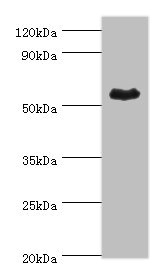 ALDH1A1 / ALDH1 Antibody - Western blot All lanes: Retinal dehydrogenase 1 antibody at 4µg/ml + Mouse liver tissue Secondary Goat polyclonal to rabbit IgG at 1/10000 dilution Predicted band size: 55 kDa Observed band size: 55 kDa