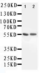 ALDH1A1 / ALDH1 Antibody - WB of ALDH1A1 / ALDH1 antibody. All lanes: Anti-ALDH1A1 at 0.5ug/ml. Lane 1: Rat Lung Tissue Lysate at 40ug. Lane 2: COLO320 Whole Cell Lysate at 40ug. Predicted bind size: 55KD. Observed bind size: 55KD.