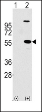 ALDH1A1 / ALDH1 Antibody - Western blot of ALDH1A1 (arrow) using rabbit polyclonal ALDH1A1 Antibody. 293 cell lysates (2 ug/lane) either nontransfected (Lane 1) or transiently transfected with the ALDH1A1 gene (Lane 2) (Origene Technologies).