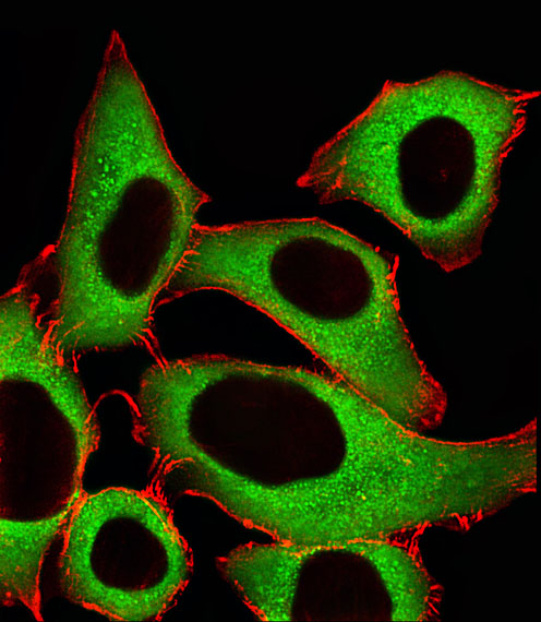 ALDH1A1 / ALDH1 Antibody - Fluorescent image of A549 cells stained with ALDH1A1 Antibody. Antibody was diluted at 1:25 dilution. An Alexa Fluor 488-conjugated goat anti-rabbit lgG at 1:400 dilution was used as the secondary antibody (green). Cytoplasmic actin was counterstained with Alexa Fluor 555 conjugated with Phalloidin (red).