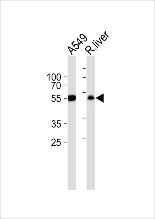 ALDH1A1 / ALDH1 Antibody - Western blot of lysates from A549 cell line and rat liver tissue lysate (from left to right) with ALDH1A1 Antibody. Antibody was diluted at 1:1000 at each lane. A goat anti-rabbit IgG H&L (HRP) at 1:5000 dilution was used as the secondary antibody. Lysates at 35 ug per lane.