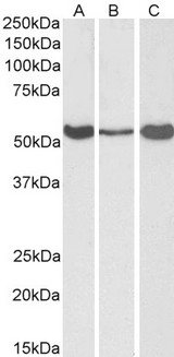 ALDH1A1 / ALDH1 Antibody - Goat Anti-ALDH1A1 (C Terminus) Antibody (0.3?/ml) staining of Human (A) and Mouse (B) Liver, and Rat (C) Testis lysate (35? protein in RIPA buffer). Primary incubation was 1 hour. Detected by chemiluminescence