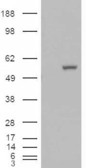 ALDH1A1 / ALDH1 Antibody - HEK293 overexpressing ALDH1A1 (RC200723) and probed with Goat Anti-ALDH1A1 (C Terminus) Antibody (mock transfection in first lane), tested by Origene.