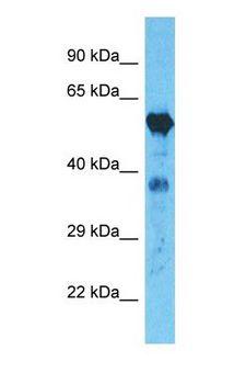 ALDH1A1 / ALDH1 Antibody - Western blot of ALDH1A1 Antibody with human A549 Whole Cell lysate.  This image was taken for the unconjugated form of this product. Other forms have not been tested.