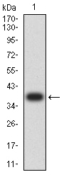 ALDH1A1 / ALDH1 Antibody - Western blot analysis using ALDH1A1 mAb against human ALDH1A1 (AA: 1-110) recombinant protein. (Expected MW is 38.4 kDa)