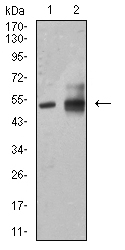 ALDH1A1 / ALDH1 Antibody - Western blot analysis using ALDH1A1 mouse mAb against HepG2 (1) and A549 (2) cell lysate.