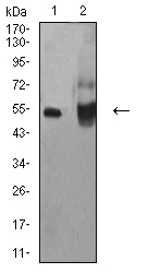 ALDH1A1 / ALDH1 Antibody - Western blot analysis using ALDH1A1 mouse mAb against HepG2 (1) and A549 (2) cell lysate.