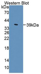 ALDH1A1 / ALDH1 Antibody - Western Blot; Sample: Recombinant protein.