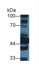 ALDH1A1 / ALDH1 Antibody - Western Blot; Sample: Mouse Liver lysate; ;Primary Ab: 3µg/ml Rabbit Anti-Mouse ALDH1A1 Antibody;Second Ab: 0.2µg/mL HRP-Linked Caprine Anti-Rabbit IgG Polyclonal Antibody;