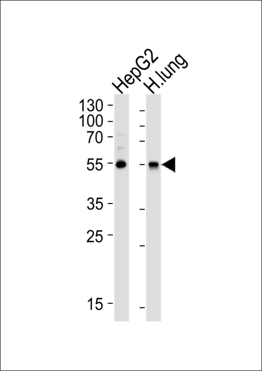 ALDH1A1 / ALDH1 Antibody - Western blot of lysates from HepG2 cell line and human lung tissue lysate (from left to right), using ALDH1A1 Antibody. Antibody was diluted at 1:1000 at each lane. A goat anti-rabbit IgG H&L (HRP) at 1:5000 dilution was used as the secondary antibody. Lysates at 35ug per lane.