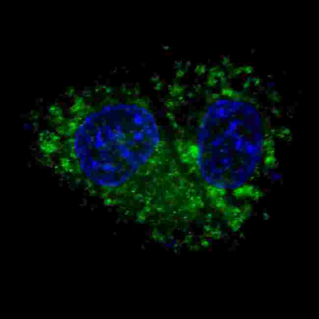 ALDH1A1 / ALDH1 Antibody - Fluorescent confocal image of HepG2 cells stained with ALDH1A1 antibody. HepG2 cells were fixed with 4% PFA (20 min), permeabilized with Triton X-100 (0.2%, 30 min). Cells were then incubated ALDH1A1 primary antibody (1:100, 2 h at room temperature). For secondary antibody, Alexa Fluor 488 conjugated donkey anti-rabbit antibody (green) was used (1:1000, 1h). Nuclei were counterstained with Hoechst 33342 (blue) (10 ug/ml, 5 min). ALDH1A1 immunoreactivity is localized to the cytoplasm of HepG2 cells.