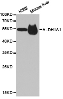 ALDH1A1 / ALDH1 Antibody - Western blot of extracts of various cell lines, using ALDH1A1 antibody.