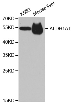 ALDH1A1 / ALDH1 Antibody - Western blot analysis of extracts of various cell lines.