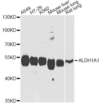 ALDH1A1 / ALDH1 Antibody - Western blot analysis of extracts of various cell lines, using ALDH1A1 antibody at 1:1000 dilution. The secondary antibody used was an HRP Goat Anti-Rabbit IgG (H+L) at 1:10000 dilution. Lysates were loaded 25ug per lane and 3% nonfat dry milk in TBST was used for blocking. An ECL Kit was used for detection and the exposure time was 20s.