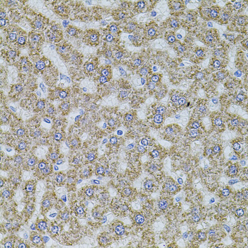 ALDH1A1 / ALDH1 Antibody - Immunohistochemistry of paraffin-embedded rat liver using ALDH1A1 antibodyat dilution of 1:100 (40x lens).