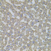 ALDH1A1 / ALDH1 Antibody - Immunohistochemistry of paraffin-embedded rat liver using ALDH1A1 antibodyat dilution of 1:100 (40x lens).