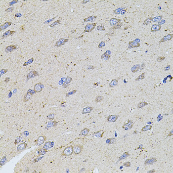 ALDH1A1 / ALDH1 Antibody - Immunohistochemistry of paraffin-embedded rat brain using ALDH1A1 antibodyat dilution of 1:100 (40x lens).