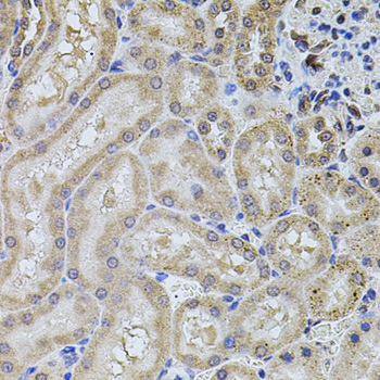 ALDH1A1 / ALDH1 Antibody - Immunohistochemistry of paraffin-embedded rat kidney using ALDH1A1 antibodyat dilution of 1:100 (40x lens).