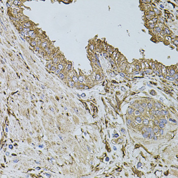 ALDH1A1 / ALDH1 Antibody - Immunohistochemistry of paraffin-embedded human prostate using ALDH1A1 antibodyat dilution of 1:100 (40x lens).