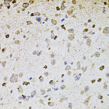 ALDH1A1 / ALDH1 Antibody - Immunohistochemistry of paraffin-embedded mouse brain using ALDH1A1 antibodyat dilution of 1:100 (40x lens).