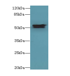 ALDH1A1 / ALDH1 Antibody - Western blot. All lanes: Aldh1a1 antibody at 8 ug/ml+ Mouse eye tissue Goat polyclonal to rabbit at 1:10000 dilution. Predicted band size: 55 kDa. Observed band size: 55 kDa.